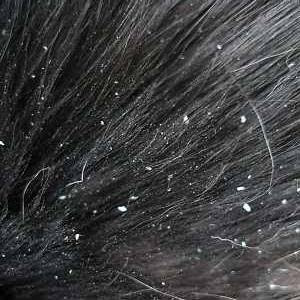 Dandruff in cat hair